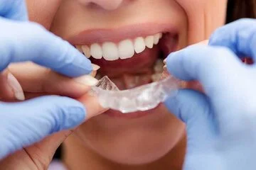 Invisalign Windsor